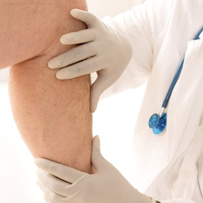 tratamiento medico de varices
