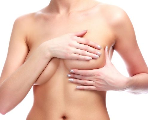 La solución para los pechos caídos: mastopexia