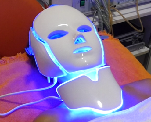 Tratamiento de acné con fotototerapia con máscara LED